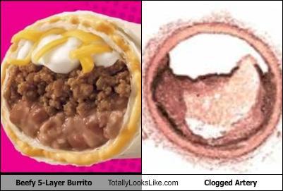 beefy_5_layer_burrito_totally_looks_like_clogged_artery.jpg